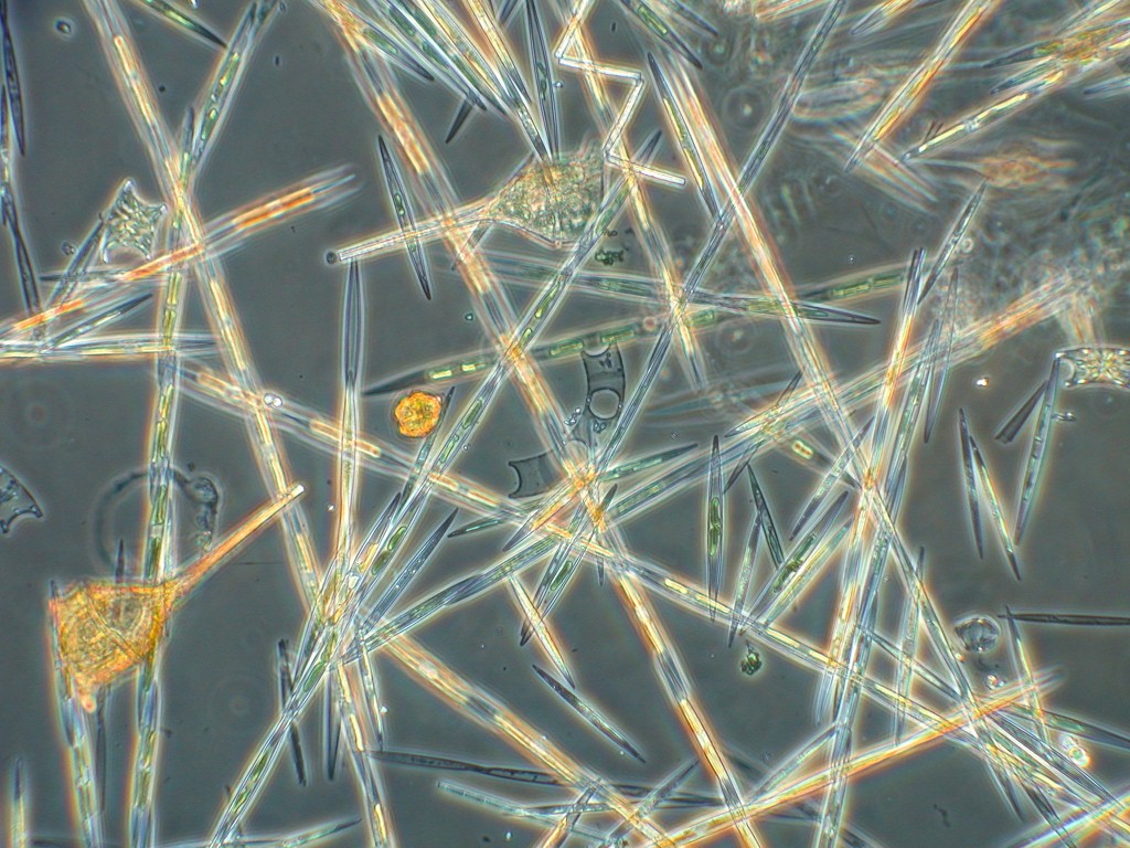 This phytoplankton is called Pseudo-nitzschia. It causes harmful algal blooms that are colorless. Image courtesy of the Raphael Kudela Lab UCSC.